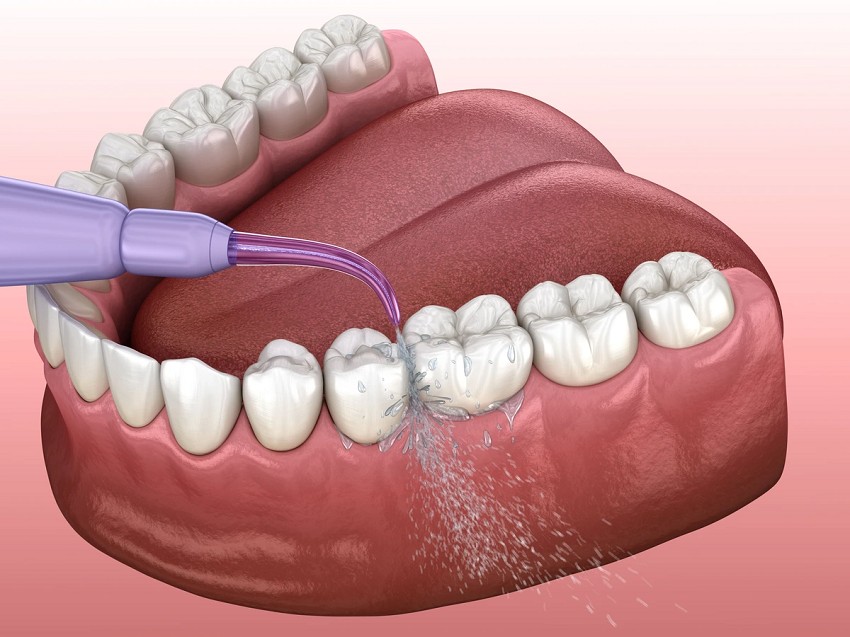 9 Instructions for Use of Water Dental Flosser