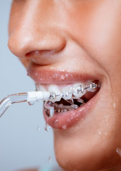 Is a water flosser good for braces ?