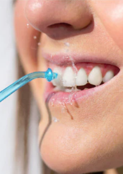 Water flosser is an effective tool for cleaning wisdom teeth