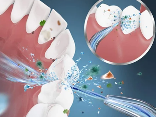 Can oral irrigator replace flossing?