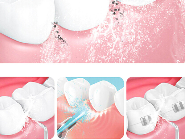 What group of people are oral irrigators suitable for?