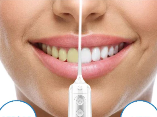 Can water flosser replace flossing reddit?