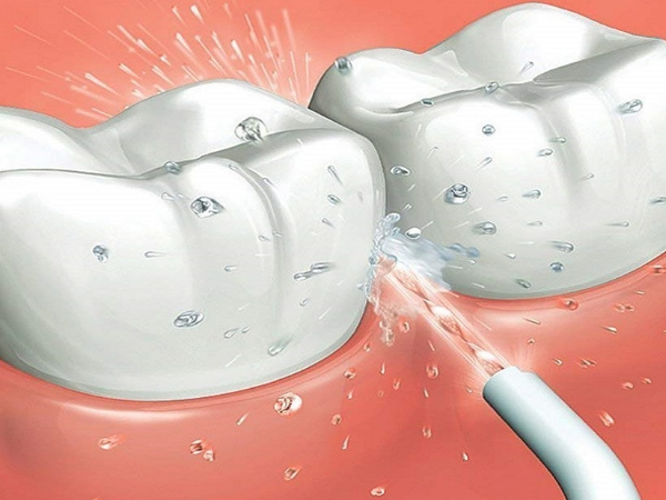 Do water flosser replace flossing?